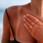 90% del cáncer a la piel es por sobreexposición al Sol: cómo cuidarte y elegir el mejor protector