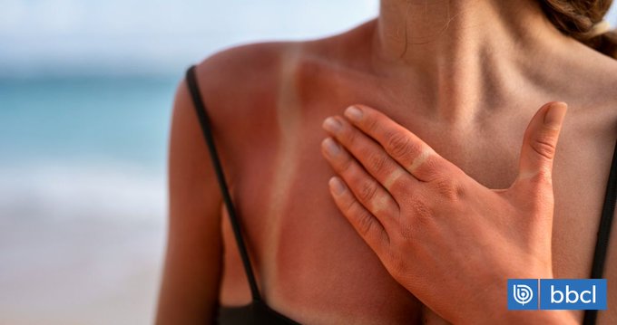 90% del cáncer a la piel es por sobreexposición al Sol: cómo cuidarte y elegir el mejor protector